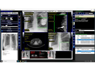 DICOM Workstation for radiologist and laboratory assist