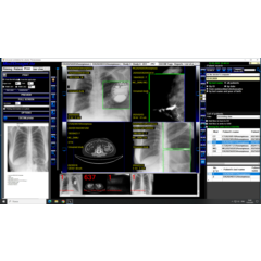 DICOM Рабочая станция врача-рентгенолога и лаборанта